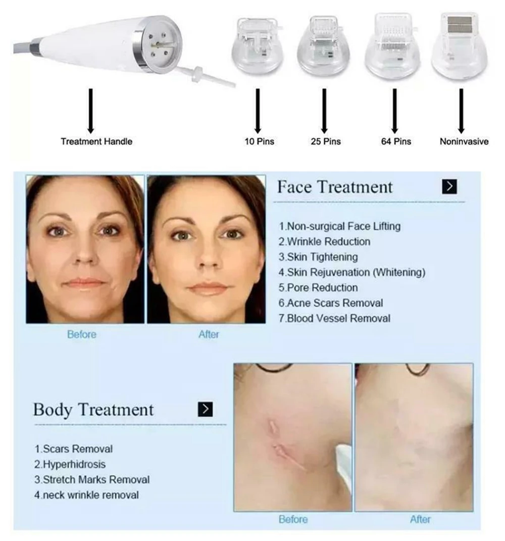 Gold RF Microneedle Accessory Cartridge 10 Pins/25 Pins/64 Pins Effectively Reduces Wrinkles And Whitens Skin and Eliminates Acne Marks CE/ROHS