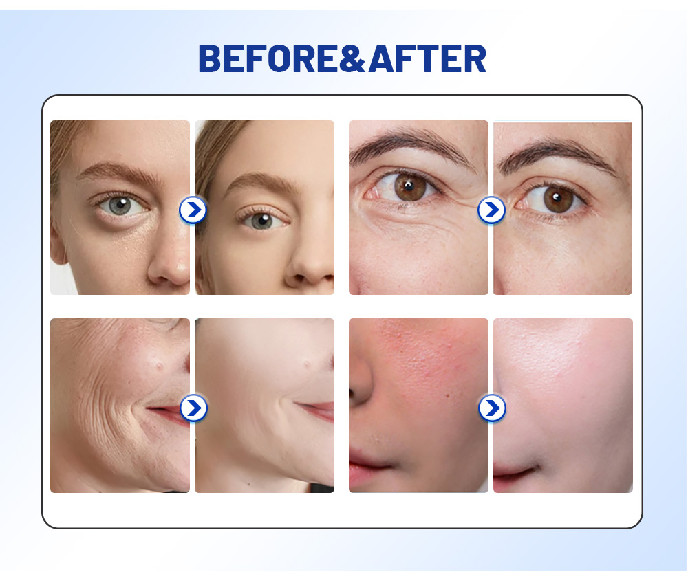 Desktop Ultrasonic Skin Care Instrument Tightening Lifting Acne Removal Fat Reduction Whitening
