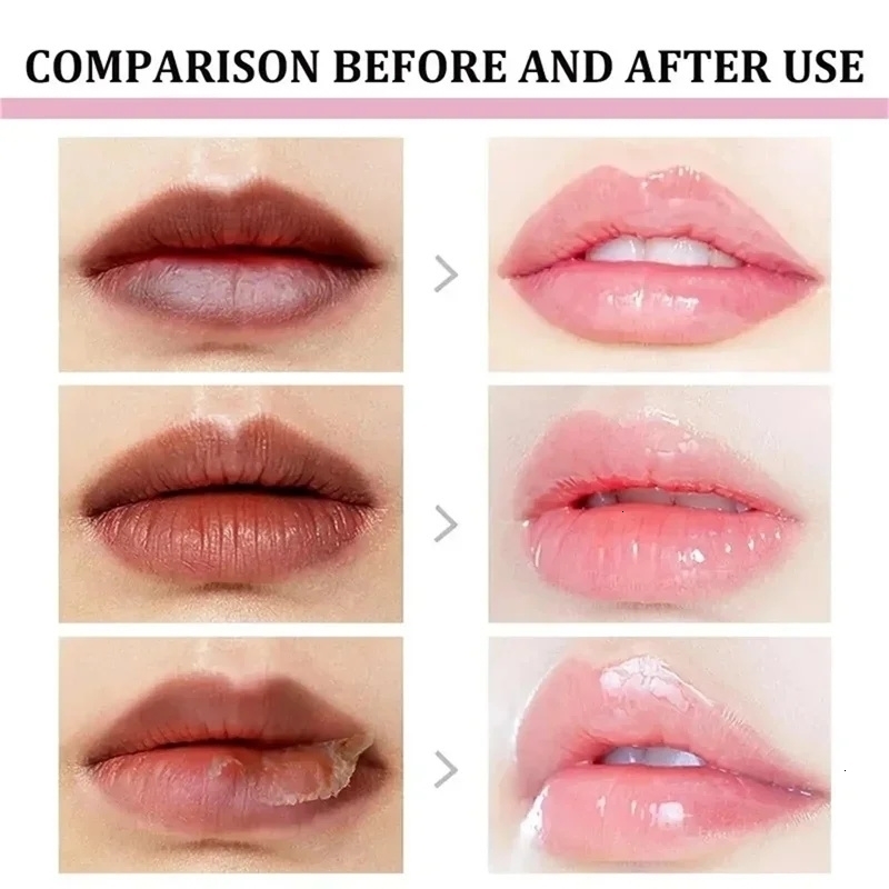 Remove Dark Lip Balm Fast Pink Exfoliating Fade Line Dead Skin Moisturizer Korean Care Products Beauty Health y250730 - view 9