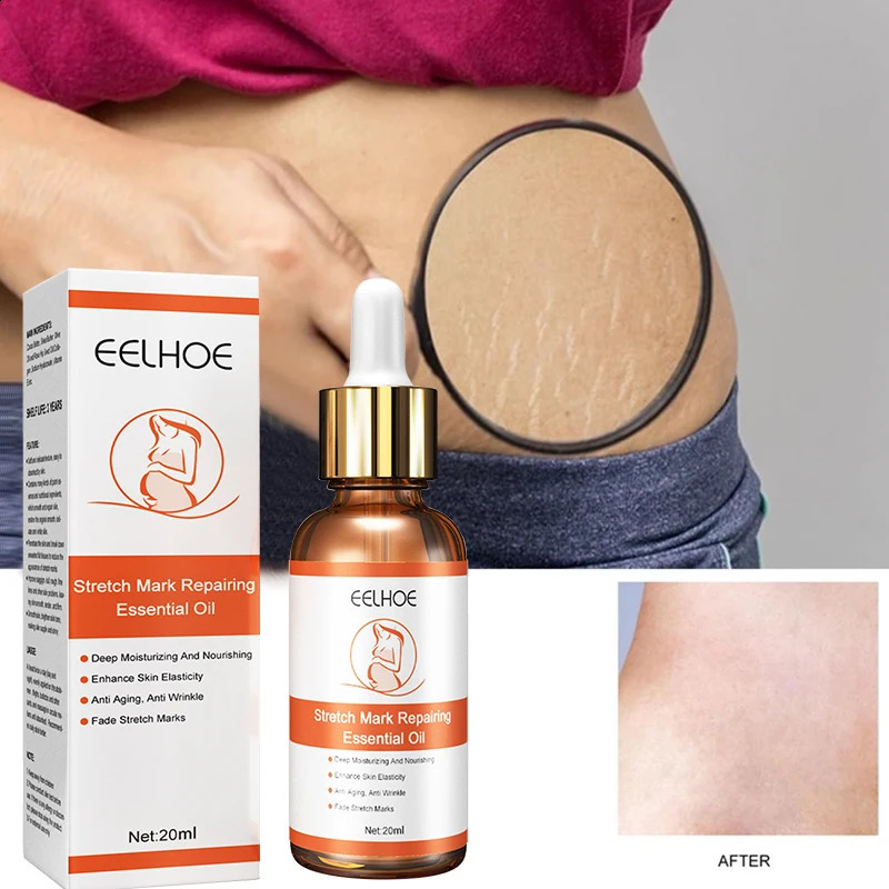 Scar Essential Oil Stretch Mark Remove Deep ize Serum Enhance Skin Care Maternity Lift Lines Firm Liquid 250812