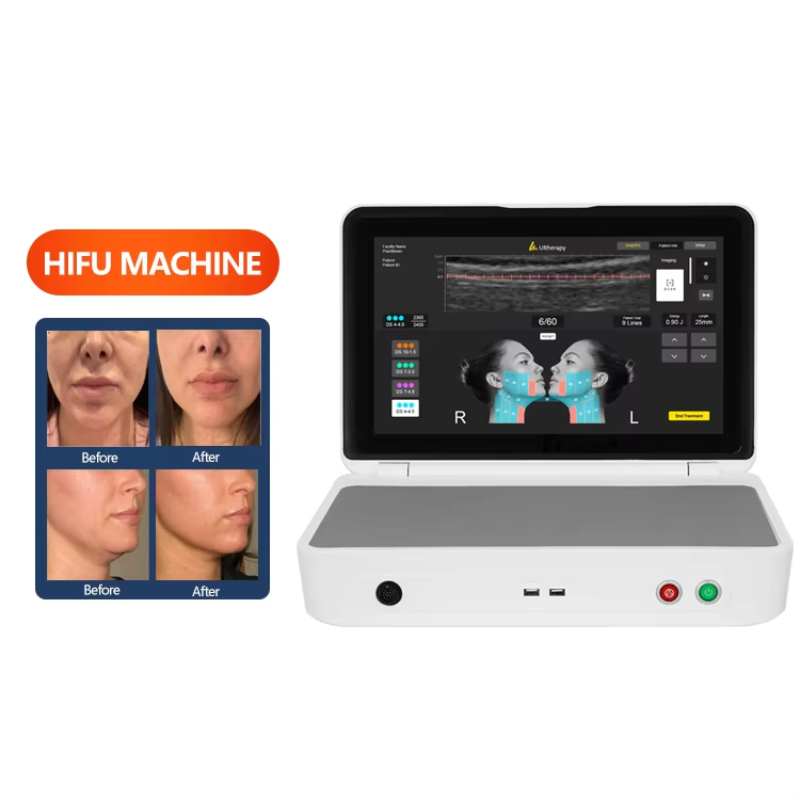 3D 4D Cartridges Ultrasound Hifu Machine Wrinkle Removal Facial and Body Care Hifu Face Rejuvenation Body Slimming Tax Free