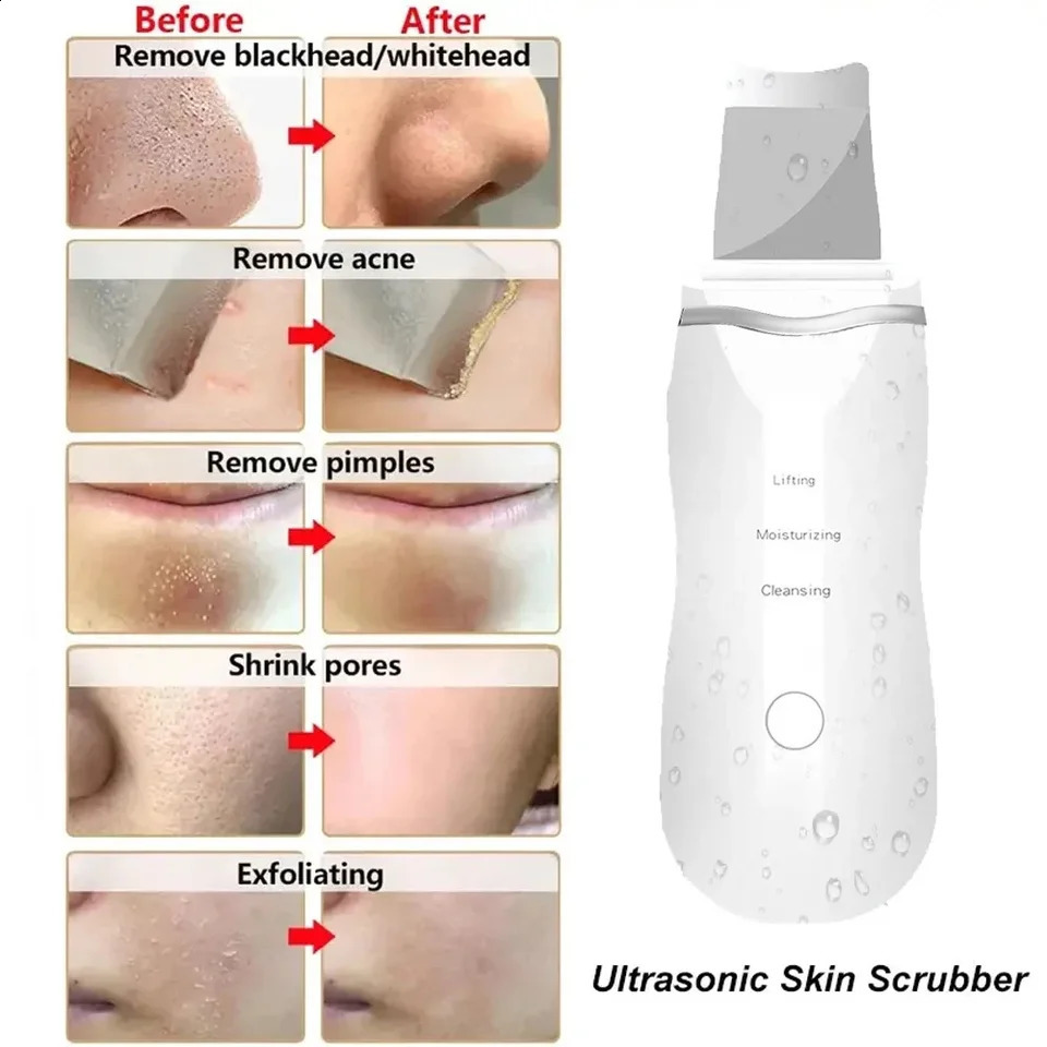 Ultrasonic Skin Scrubber Peeling Blackhead Remover Deep Face Cleaning Pore Cleaner Shovel Cleanser EMS Microcurrent 250820