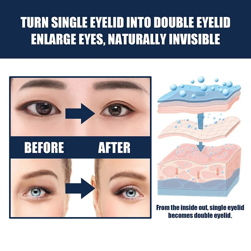 Double Eyelid Tape Invisible Lace Olive Shape Type Lasting Waterproof Glue-free Natural Mesh Will Stick Beautiful Eye 250224