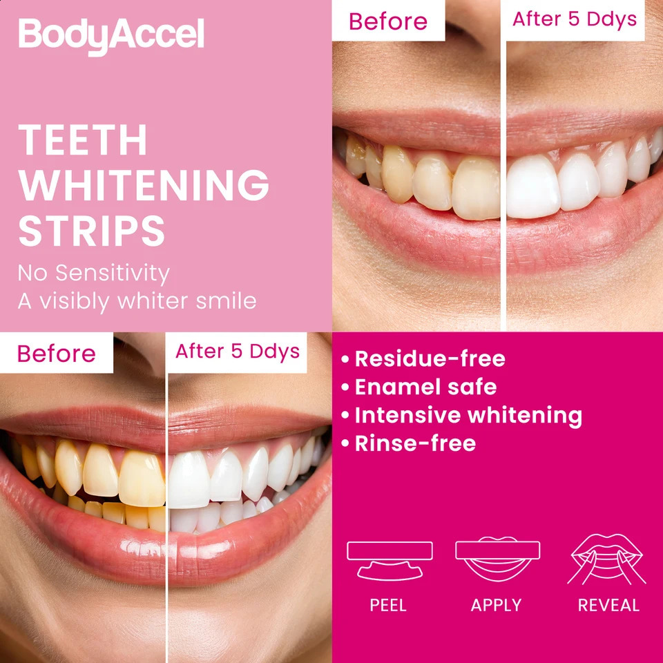 BODYACCEL Teeth Whitening Strips 14-Day Visible Whitening Gentle Non-Sensitive Stain Removal Color 250227