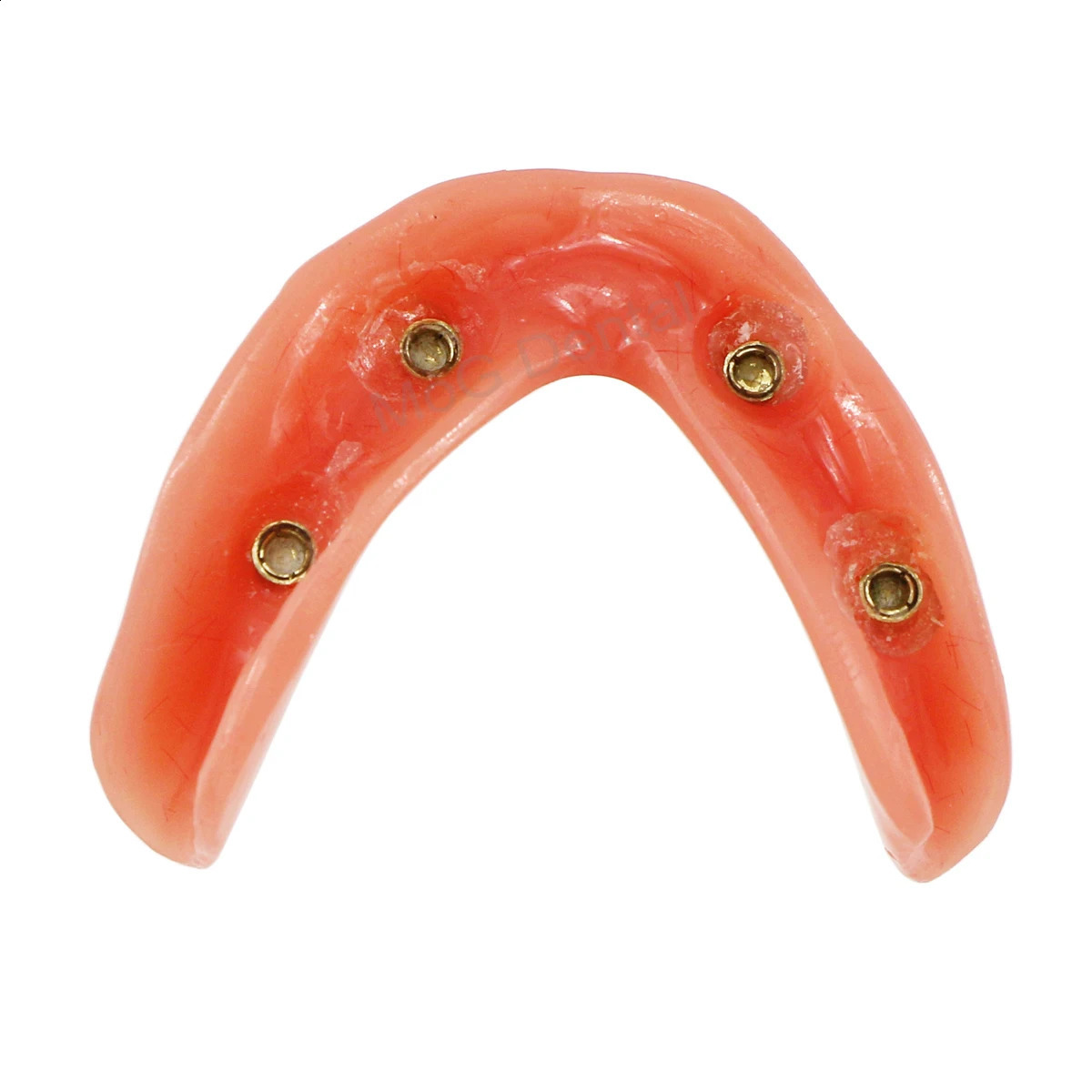 Dental Implant Teeth Model with Overdenture Inferior Demo 4 Implants Dental Teaching Model for Lab Demonstration Tools M6003 250228