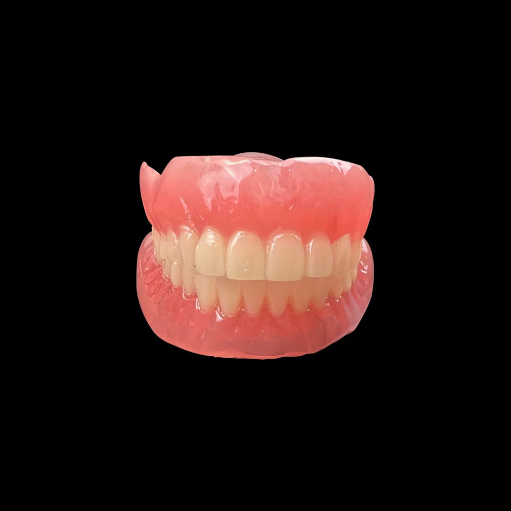 Dental Teaching Model Implant Teeth Model Removable Upper Lower Jaw Models Maxillary Mandibular With 4 Implant Study Overdenture 250228