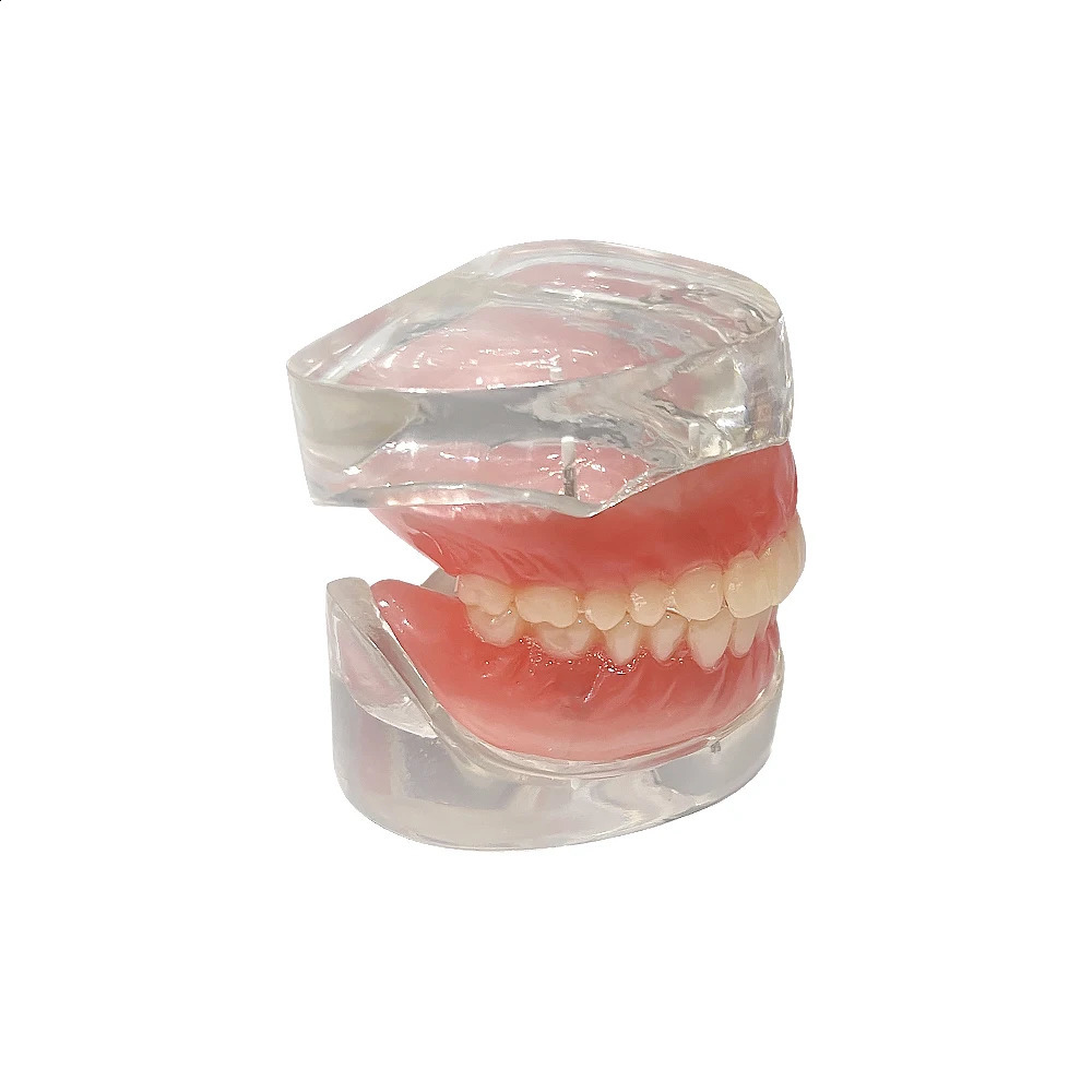 Dental Teaching Model Implant Teeth Model Removable Upper Lower Jaw Models Maxillary Mandibular With 4 Implant Study Overdenture 250228
