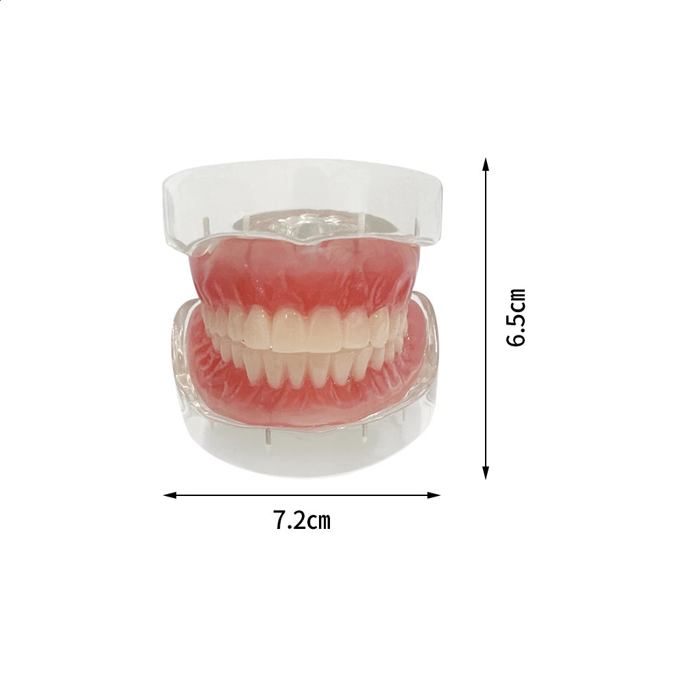 Dental Teaching Model Implant Teeth Model Removable Upper Lower Jaw Models Maxillary Mandibular With 4 Implant Study Overdenture 250228