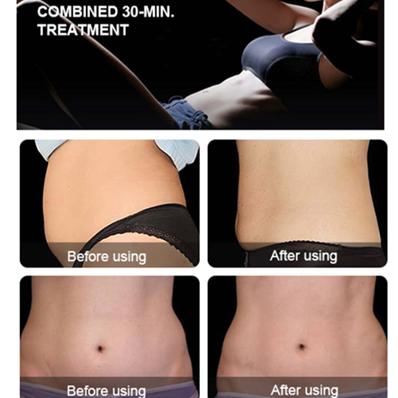 EMS Neo RF Body Sculpting Muscle Stimulate Hiemt Body Slimming Contouring Machine