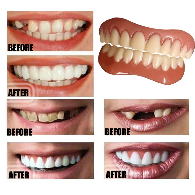 False Teeth Silicone Upper Lower Veneers Dentures Paste Fake Teeth Braces Perfect Laugh Veneers Comfortable Teeth Orthodontic Ma 250228