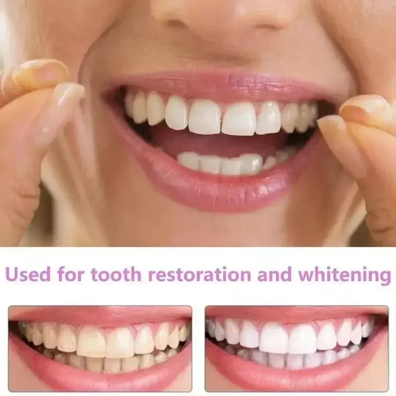 Adult adjustable denture set denture clasps portable braces decorative gaps to improve dental aesthetics 250228
