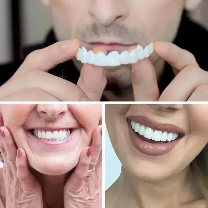 Adult adjustable denture set denture clasps portable braces decorative gaps to improve dental aesthetics 250228