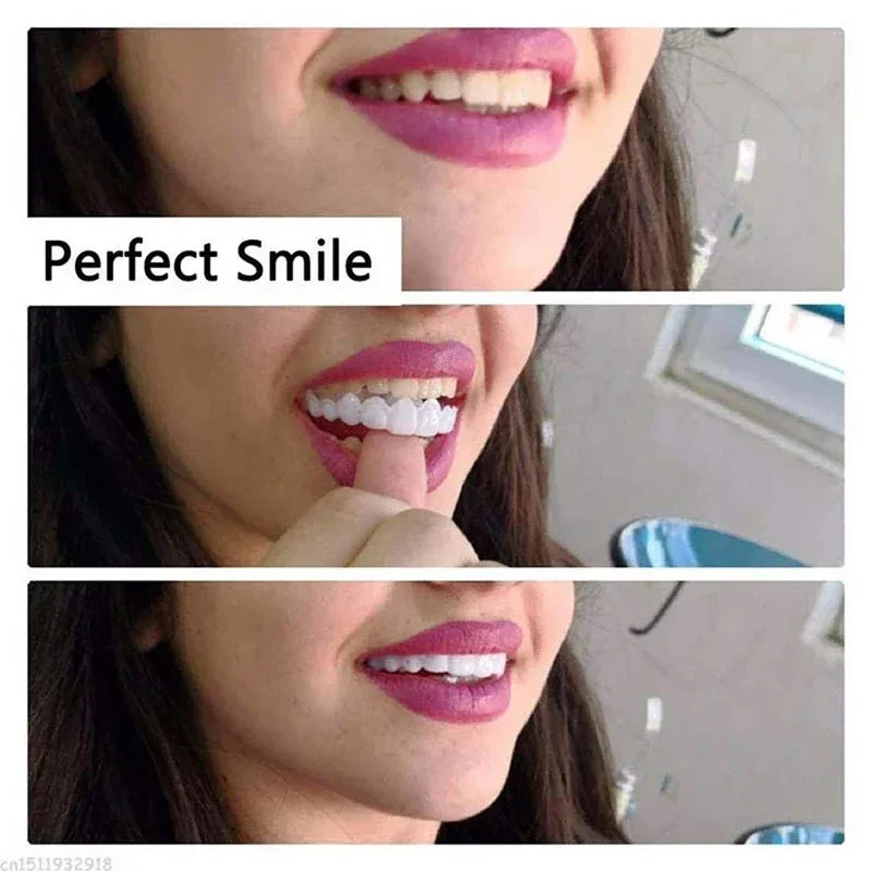 Veneer Snap-on Teeth Kit Fake Temporary Tooth Whitening Replacement Temporary Tooth Replacement Men Women Portable Nursing 250228