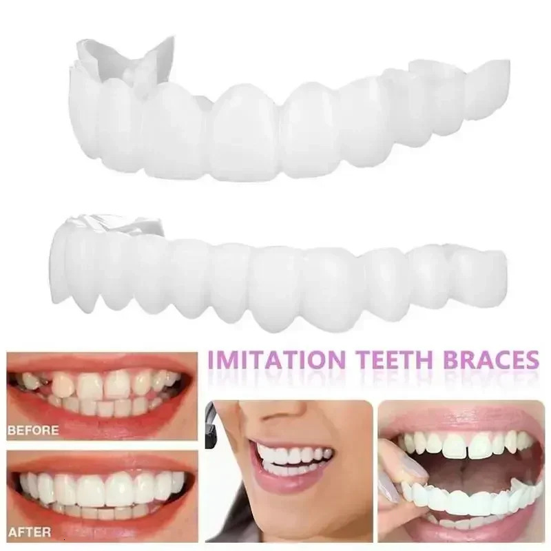 Adult adjustable denture set denture clasps portable braces decorative gaps to improve dental aesthetics 250228