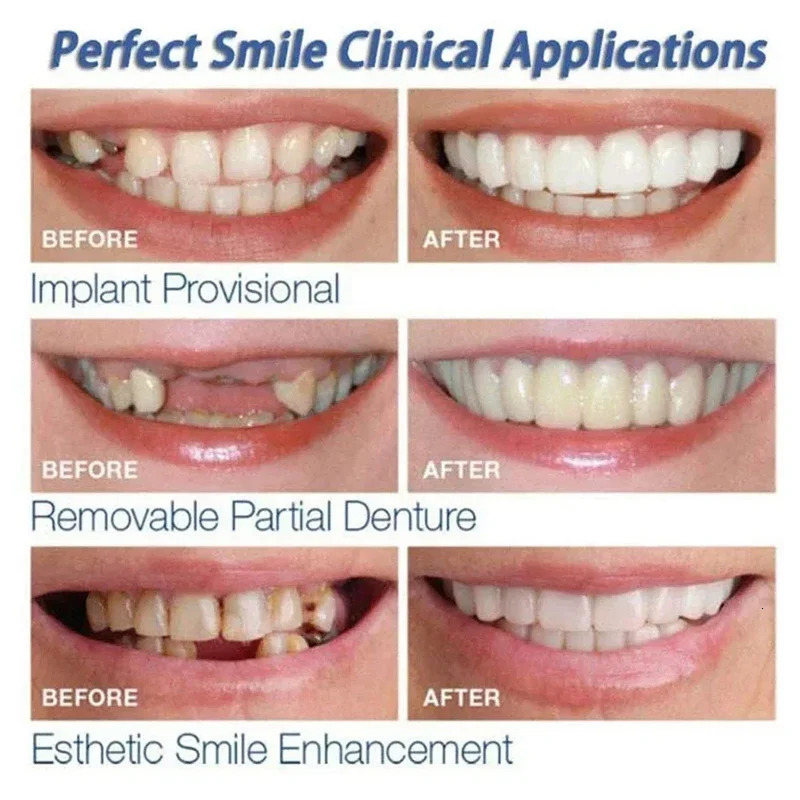 Veneer Snap-on Teeth Kit Fake Temporary Tooth Whitening Replacement Temporary Tooth Replacement Men Women Portable Nursing 250228