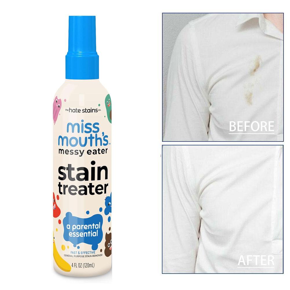 120/300ML Laundry Stain Remover Anti Germ & Deodorization For Clothes Fabric Upholstery Carpet Stain Spray Yellow Removal Bleach