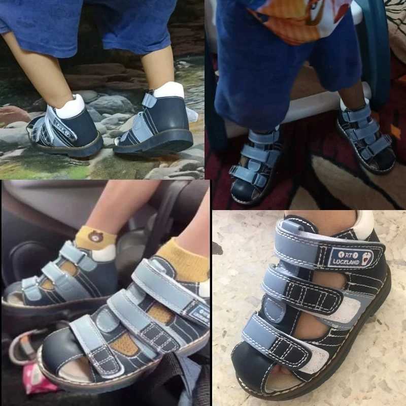 Toddler Baby Sandals Orthopedic Shoes For Kids Boys Girls Summer Tiptoe Microfiber Leather Clubfoot Footwear Size20-33 X250305