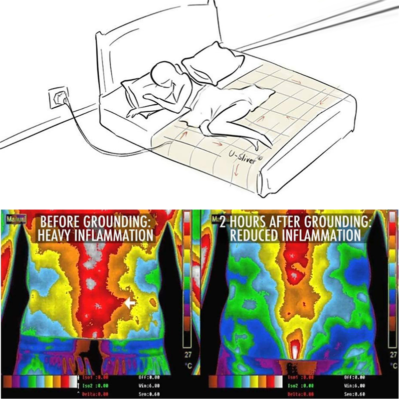 Grounding Sheet Queen Earthing Sheet Grounding Bed Sheet with Cord 95% Cotton And 5% Soft Silver Thread for Healing Sleep