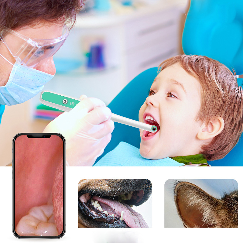 1080P High Definition Visual Wifi Dental Endoscope Ideal for Oral Exams Dental Procedures and Use Wifi Connectivity for Easy Viewing