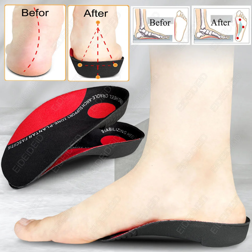 Ortic for Severe Flat Foot Arch Support Plantar Fasciitis 34 Orthopedic Insole XOShaped Legs Correction Care man women 250306