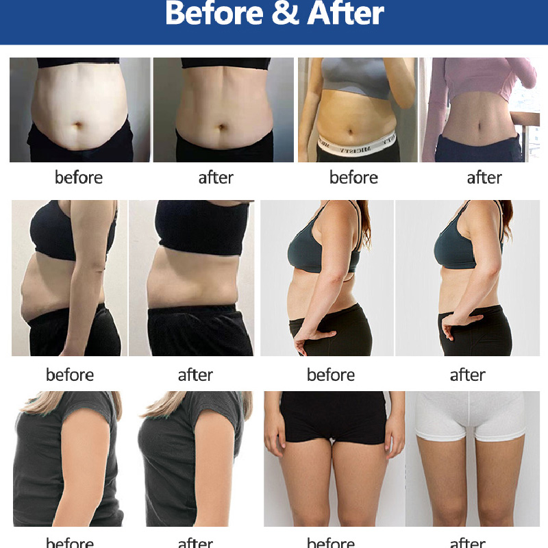 Portable ems slimming fat dissolve cryotherapy machine hiemt tightening muscle emslim body cryolipolisis machines 2 in 1