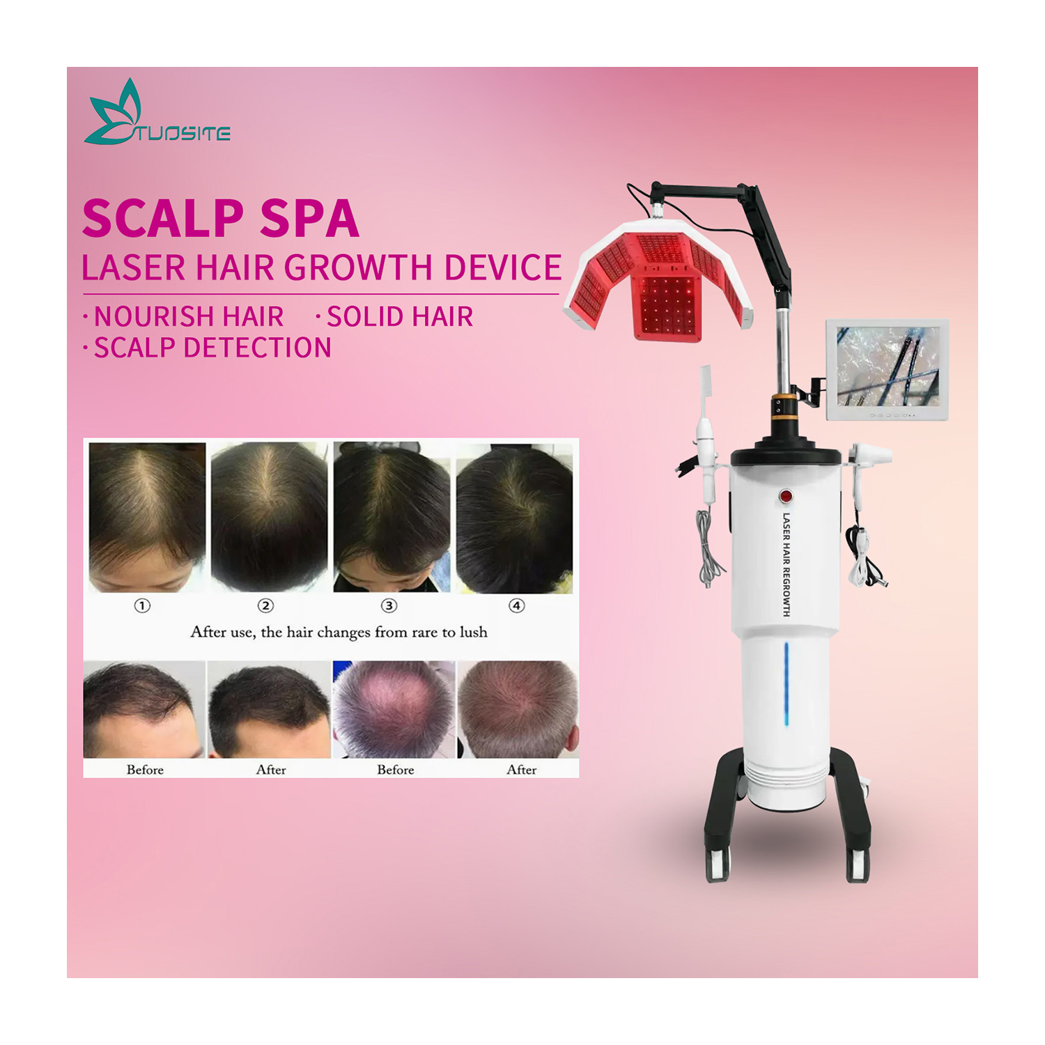 Diode Laser Hair Growth Device Low Level Therapy Hair Loss Treatment 650nm Light Regrowth Machine