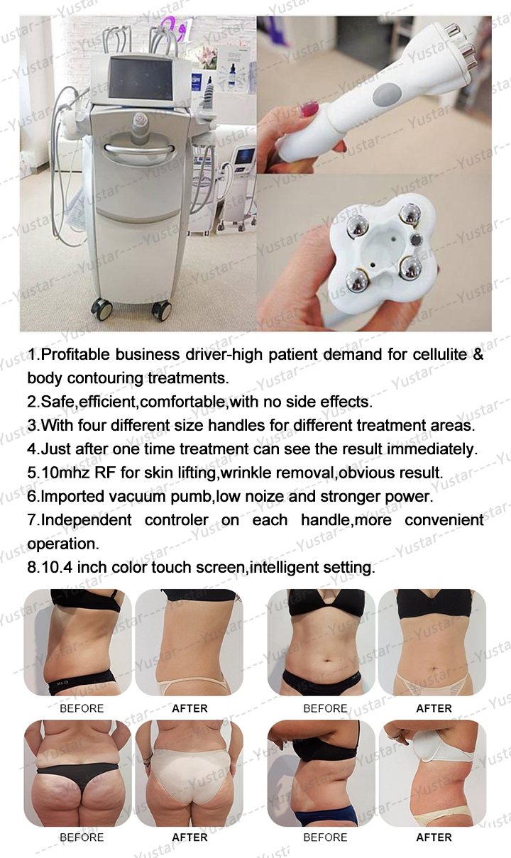 Venus Legacy Skin Beauty Equipment for Face Lifting Body Slimming Contour Tratamiento Corporal Venus Legacy Beauty Equipment