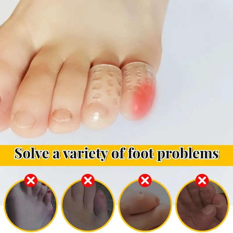 Silicone Toe Protector Soft Breathable Tube Corns Blisters Gel Little Separators Foot Care Tool 250318