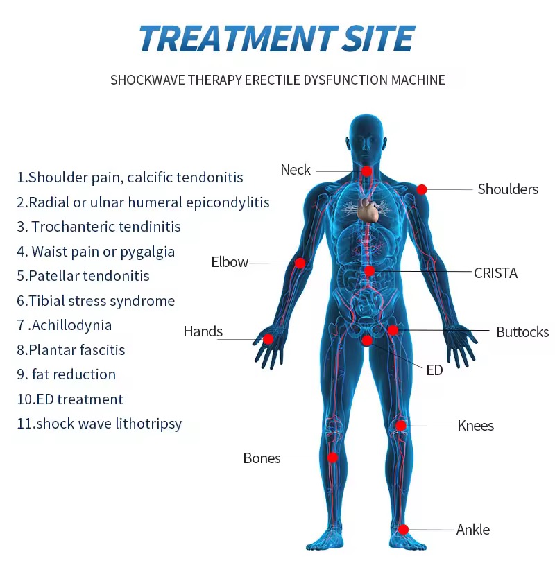Focused Erectile Dysfunction Physiotherapy Pain Relief Shock Wave Physical Therapy Equipments Eswt ED Shockwave Therapy Machine