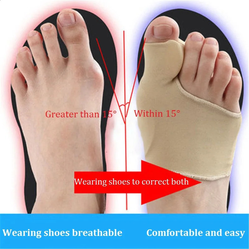 Bunion Corrector Gel Pad Stretch Nylon Hallux Valgus Protector Guard Toe Separator Orthopedic Protector Shoe Accessories 250319
