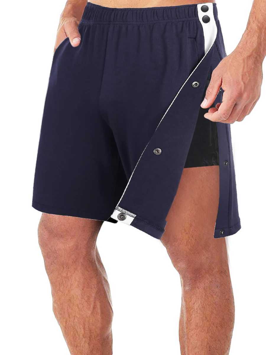 Mens casual 2023 summer shorts patch work elastic waist loose shorts side button side pocket short S-3XL W250319