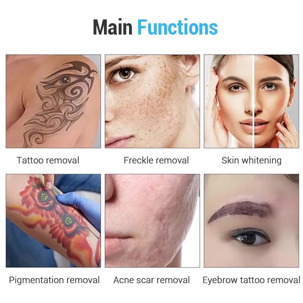 2025 Professional Picolaser Carbon Peel 532 755 1320 1064 Q-Switch Nd Yag Laser Tattoo Removal Machine Picosecond