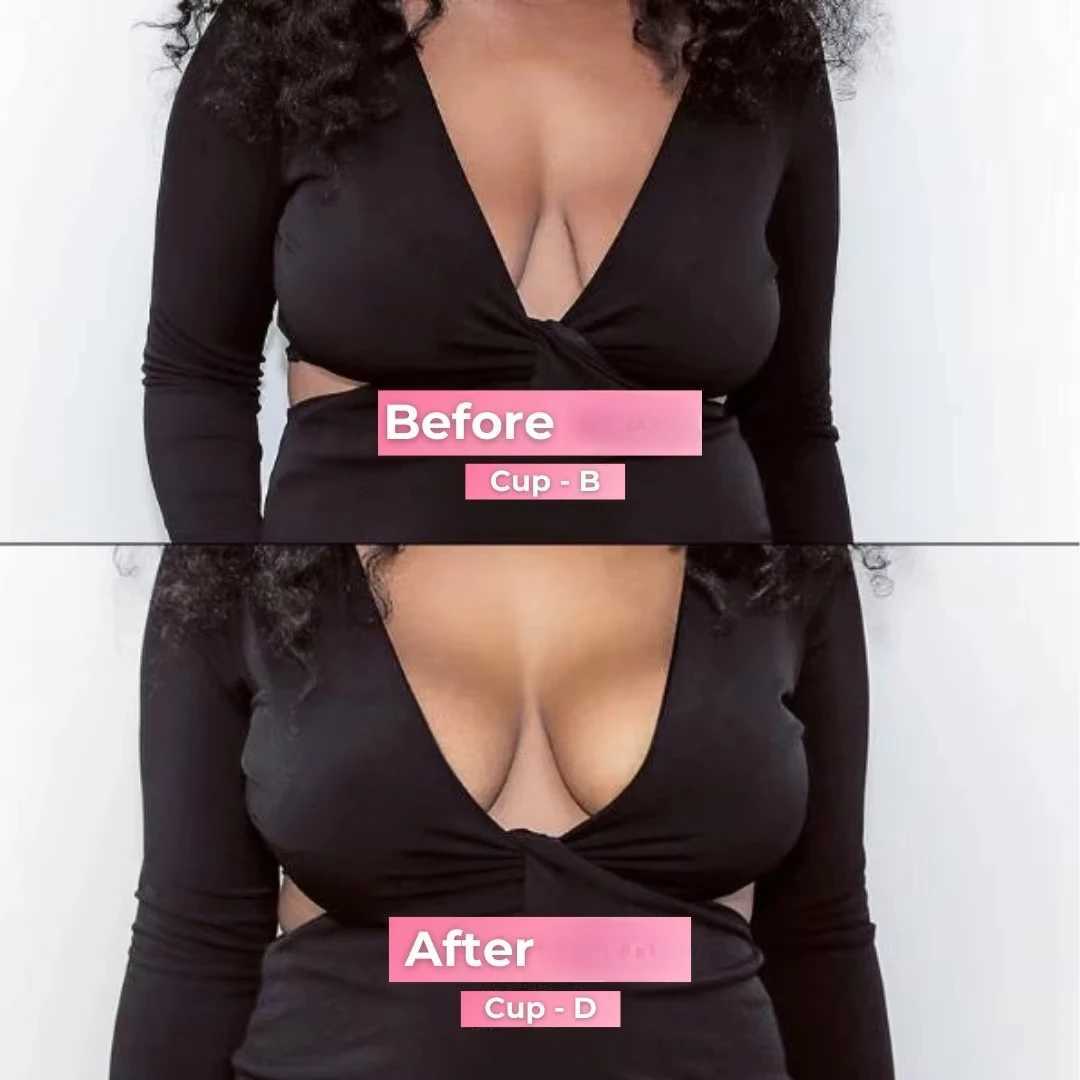 Instant Boost Adhesive Bra Insertion Self Adhesive Bra Double sided Adhesive Push up Bra Reusable Super Chest Lifting Pad InsertionXJ250324