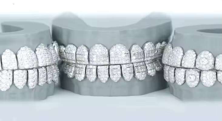 Custom Made Personalized Vvs Moissanite Diamond Dental Grills Mens Hip Hop Jewelry 14K 18K Gold Silver Iced Out Grillz for Teeth