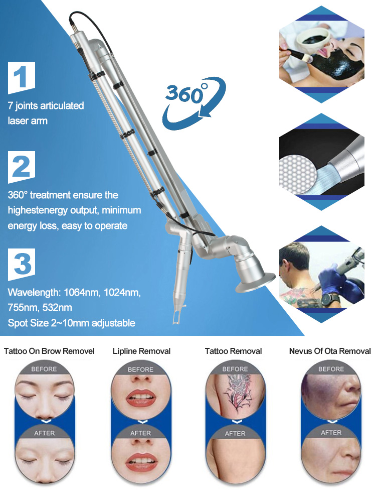 Nd Yag Laser Tattoo Removal Machine 1064 532nm Single Pulse Double and Muti Pulse Picosecond Laser Sell