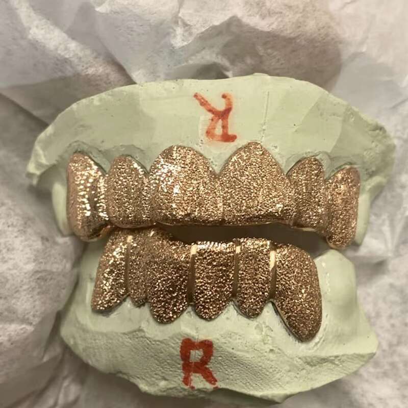 Custom S925 Silver 10k 14k 18k Solid Gold Grillz Teeth Iced Out Vvs Moissanite Lab Natural Diamond Grillz for Teeth