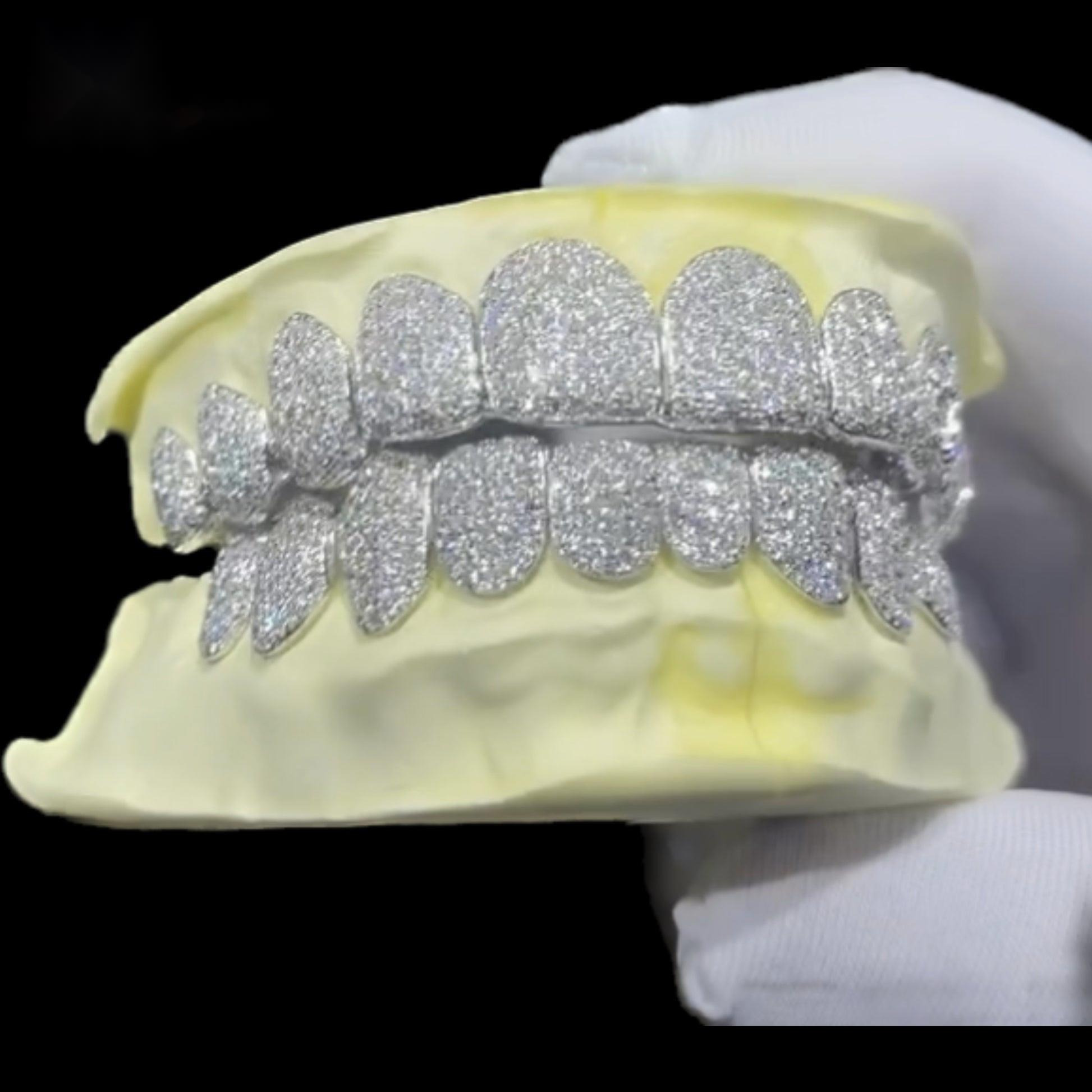 Custom 10K 14K 18K Gold Plated Silver 925 Full VVS Diamond Moissanite Grillz Iced Out Hip Hop Teeth Grillz