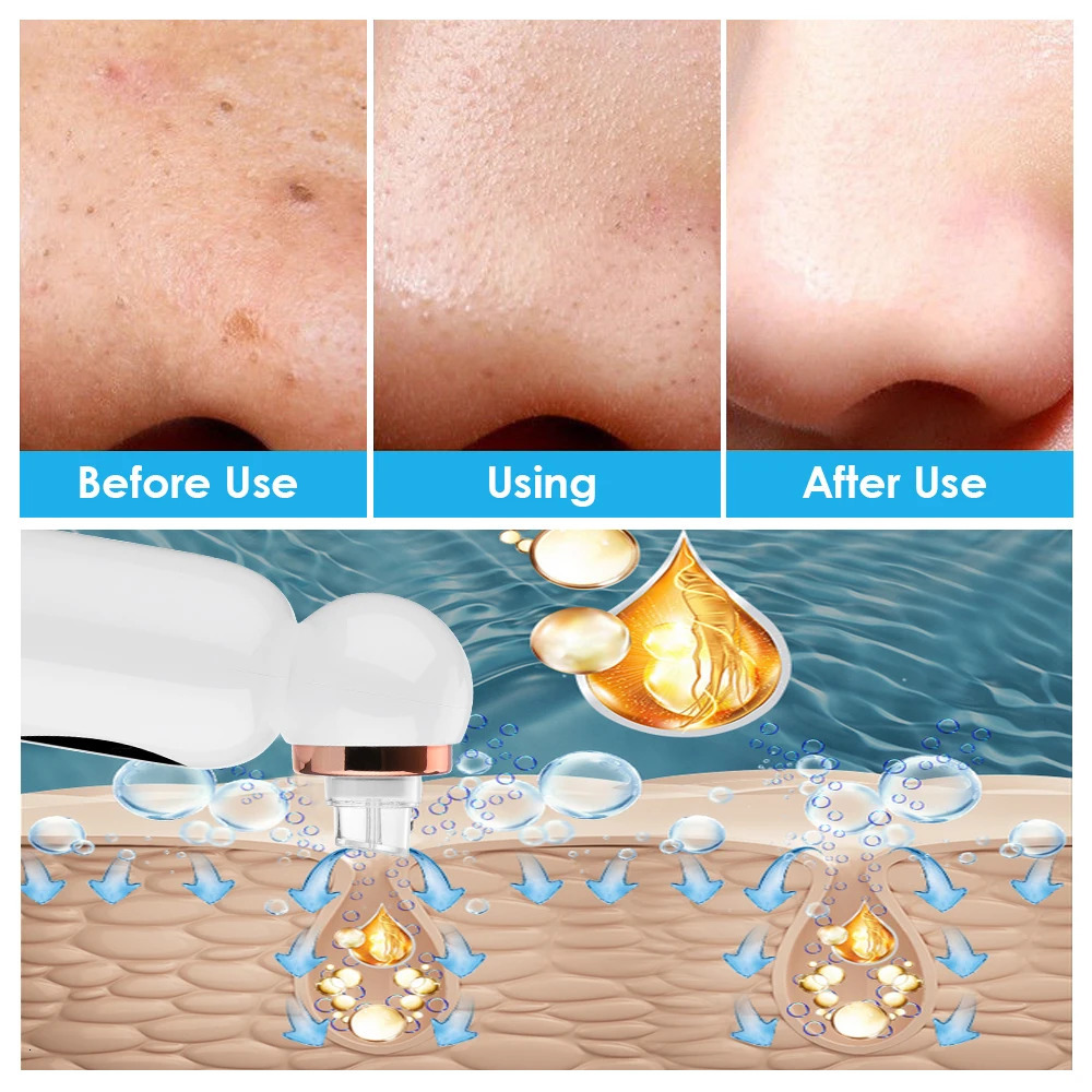 Small bubble beauty instrument home pore cleansing suction blackheads 3 suction 6 replaceable head 250422