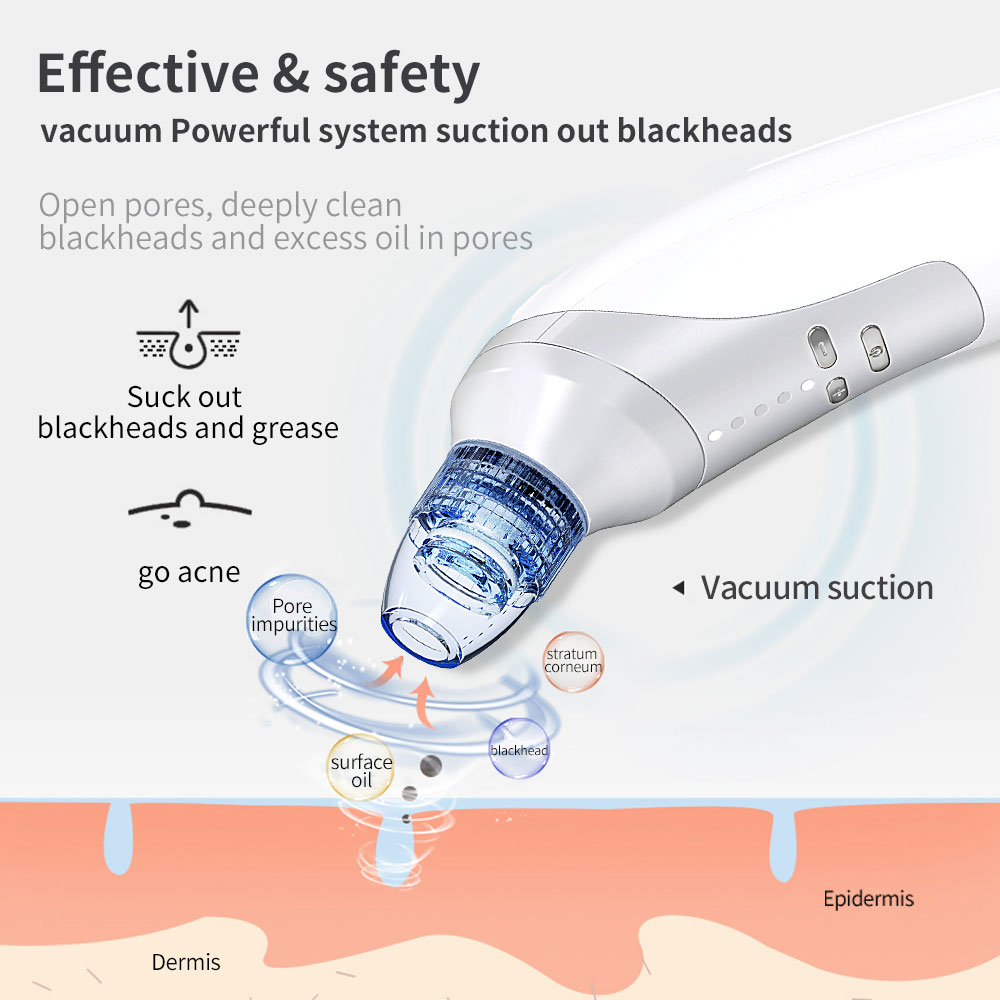 Blackhead & Acne Remover with Vacuum Suction Facial Cleansing Device for Clear Nose and Chin at Home