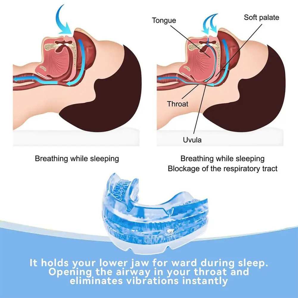 Adjustable Anti Snoring Mouth Guard Anti-Snoring Mouthpiece Sleeping Devices Bruxism Snoring Stopper Improve Sleep Mouthpiece 250506