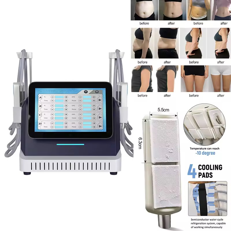 2025 New Product Launch Professional Cryotherapy Fat Reduction Ems Cryo Skin Lift Firming