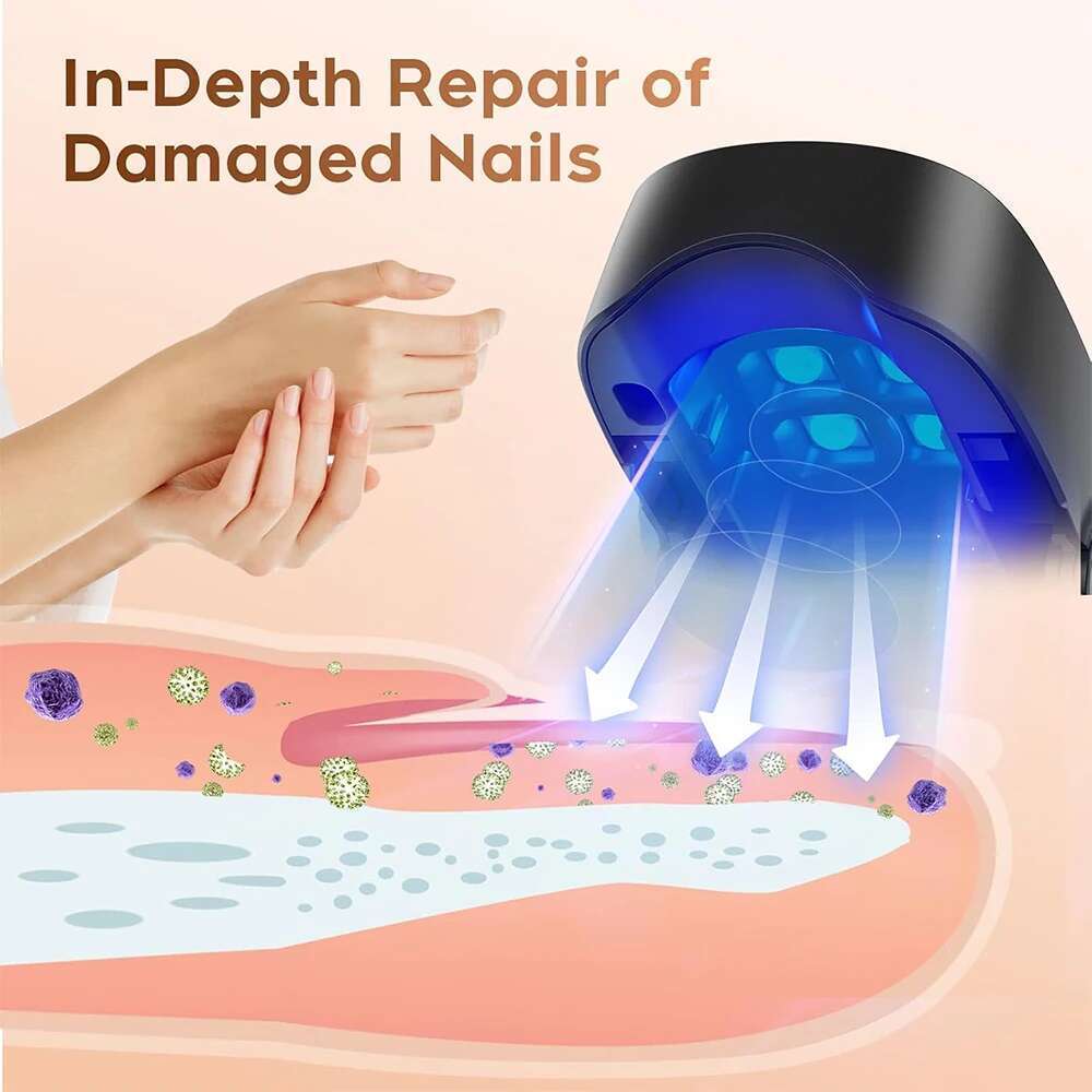 Device Fungal Treatment Repairing Thickened Gray Nails Relieve Ingrown Nail Cleaning Tools Foot Health Care