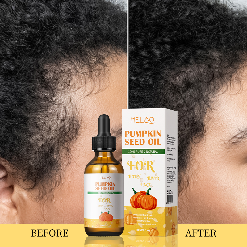 Pumpkin Seed Essential Oil - Nourishing Scalp Treatment for Smooth Strong Tresses