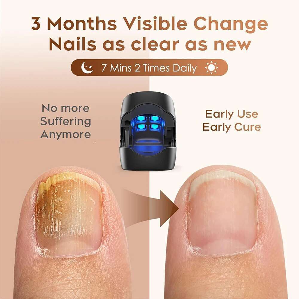 Device Fungal Treatment Repairing Thickened Gray Nails Relieve Ingrown Nail Cleaning Tools Foot Health Care