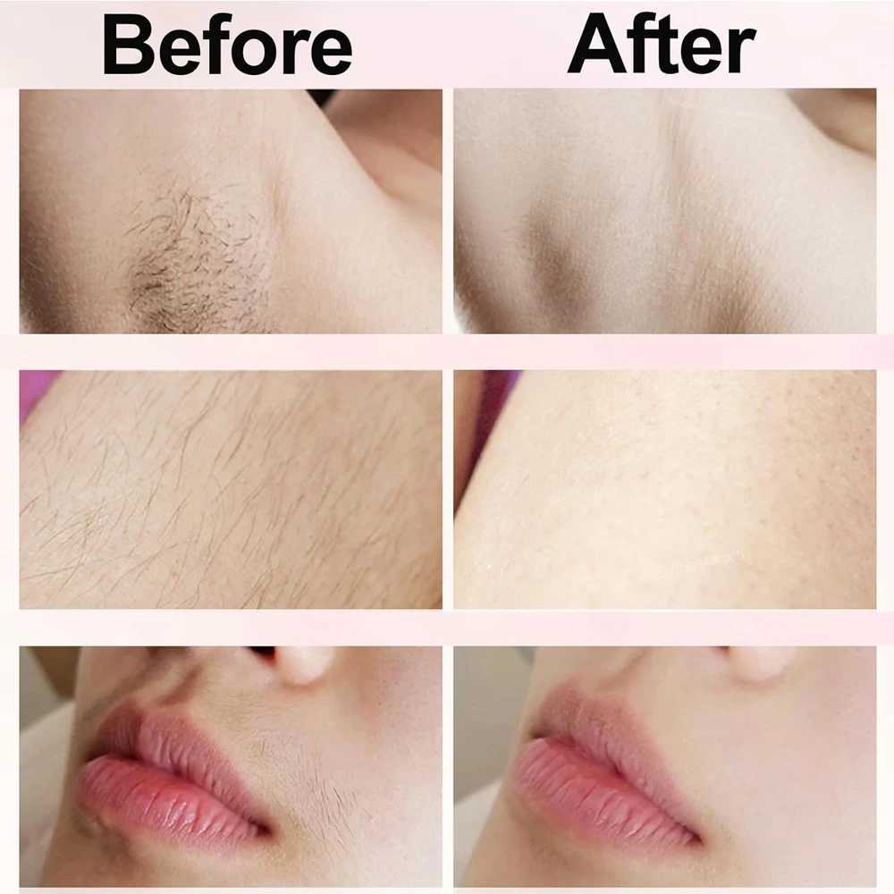 Electric Razor for Women Underarms Hair Epilator Woman Body Leg Facial Hair Removal Rechargeable Dual-Head Painless Lady Shaver W250513