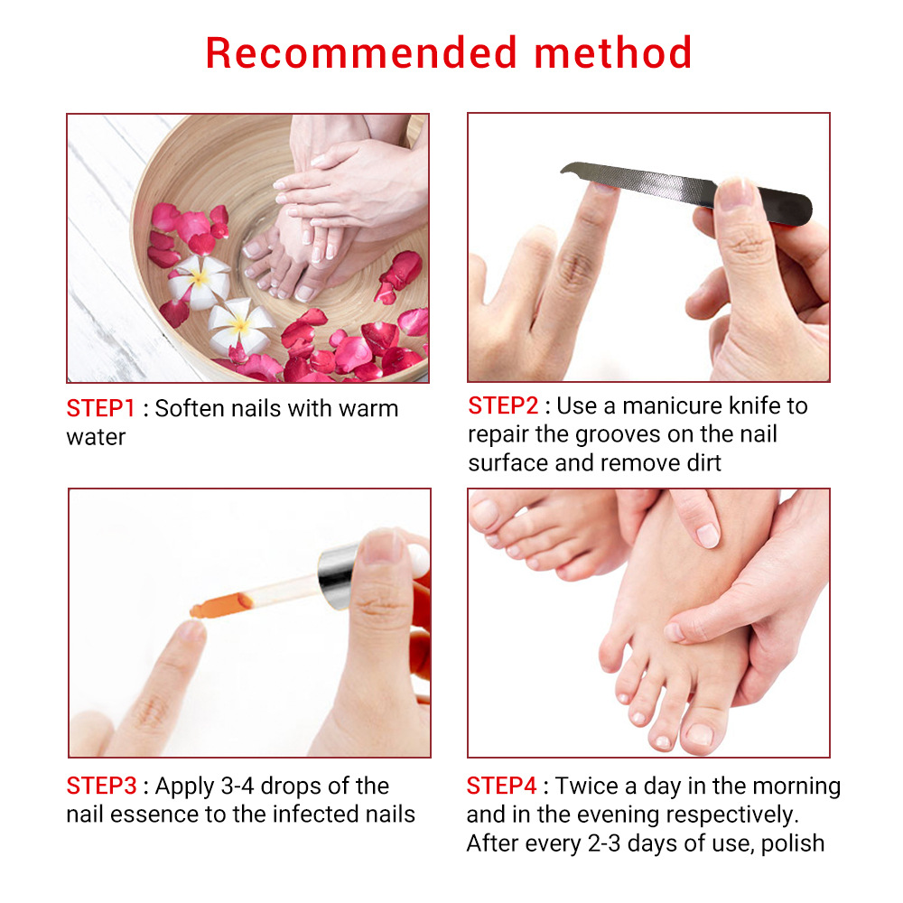 Fungal Nail Repair Essence 15ML Equipped With A Small File