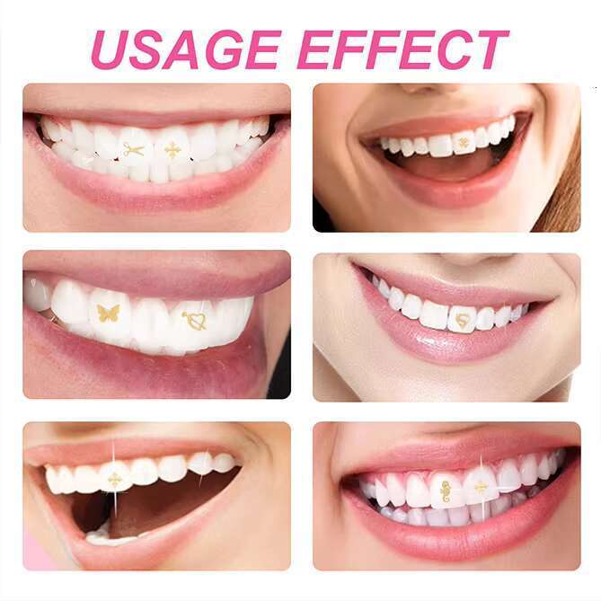 Crystal Light Curing Flowable Professional Gold Teeth Whitening Diy Dental Adhesive Set