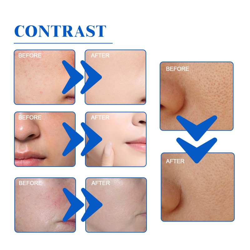 Hoygi Blueberry Facial Set - Facial Deep Cleansing Anti-Wrinkle Skin Care Set