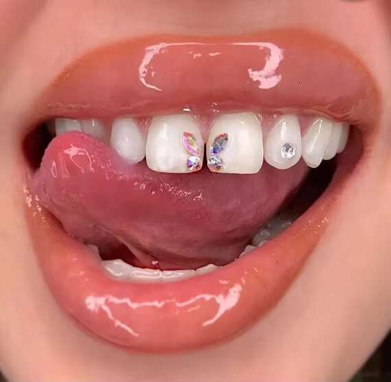 High quality flat back DIY crystal jewelry, dental teeth whitening accessories