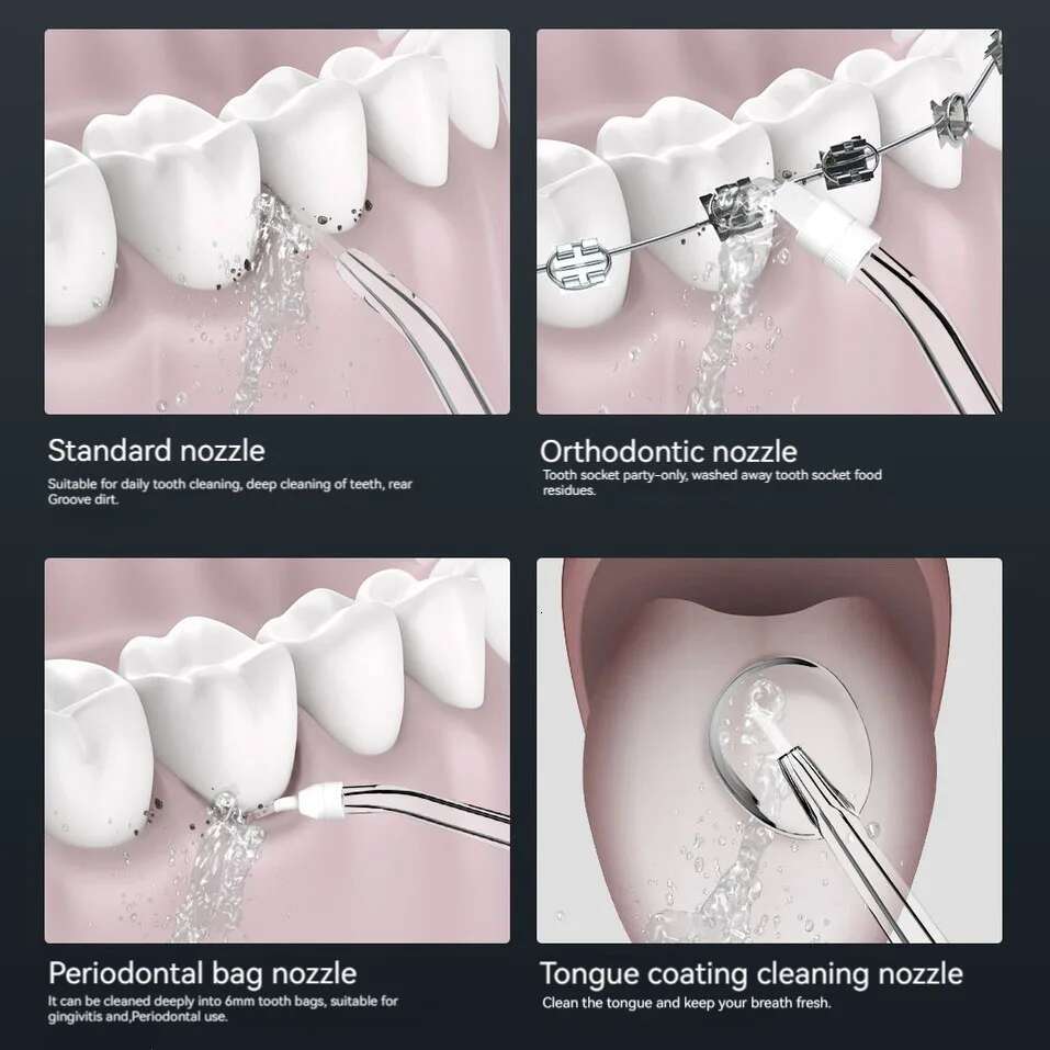 Household electric arterial irrigation convenient beauty device, water flosser, dental calculus irrigator, oral c
